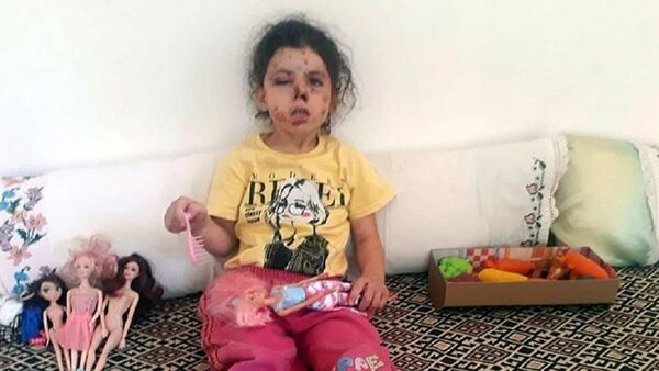  Konvoy yasağına rağmen havaya ateş açıldı, 5 yaşındaki çocuk yaralandı - Sputnik Türkiye