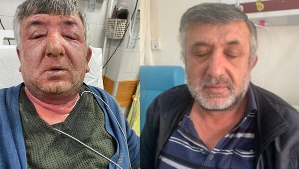 Yüzüne dezenfektan süren İsmail Özelçi - Sputnik Türkiye
