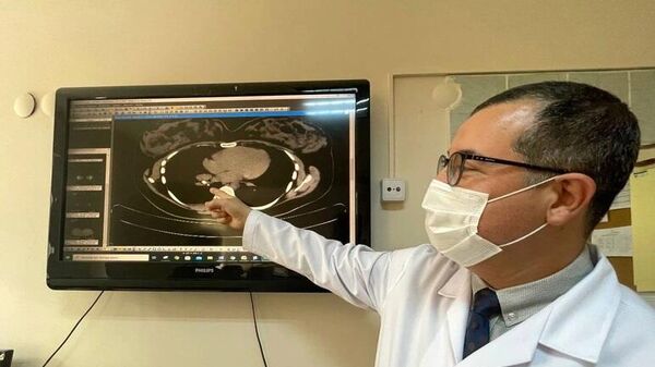 Kanser sanılan hastanın soluk borusundan badem zarı çıktı - Sputnik Türkiye