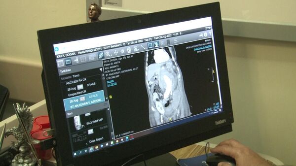böbreği yer değiştirilerek kurtarılan hastanın röntgeni - Sputnik Türkiye