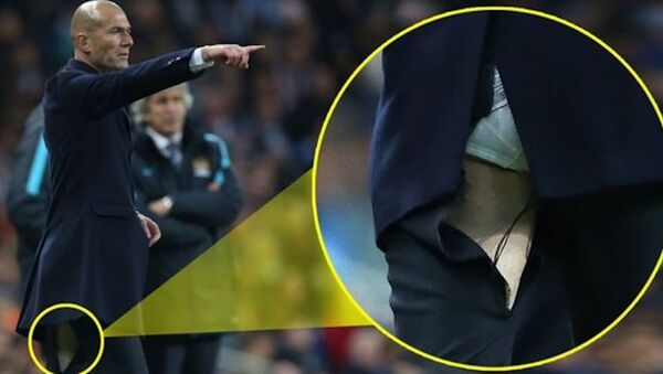 Real Madrid Teknik Direktörü Zidane'ın pantolonu yırtıldı. - Sputnik Türkiye